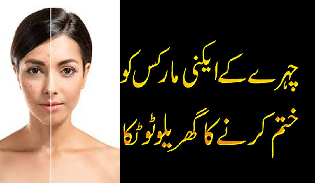 Acne Treatment At Home
