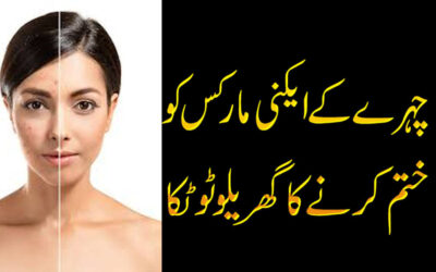 Acne Treatment At Home