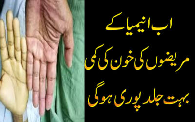 Anemia Ka Mareez Ko Kya Khana Chahye