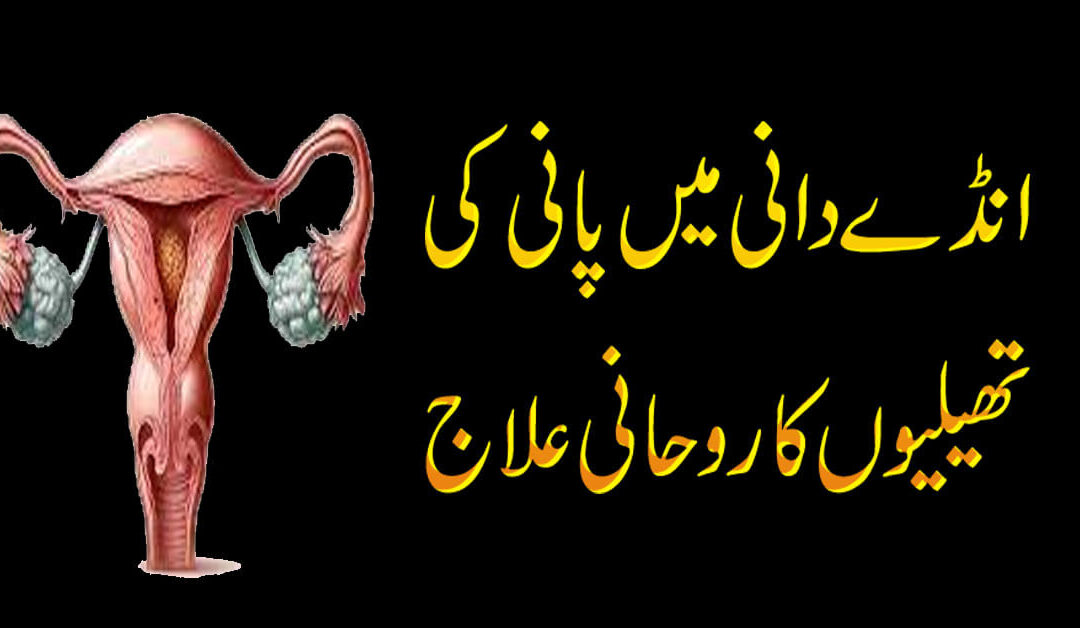 Ovary Mein Pani Bhar Janae Ka Rohani Ilaj