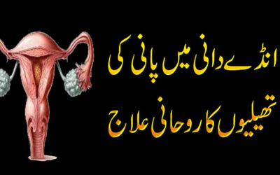 Ovary Mein Pani Bhar Janae Ka Rohani Ilaj