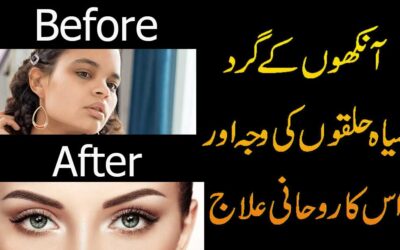 Dark Circle Ka Rohani Ilaj