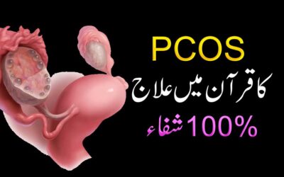 PCOS Se 100% Shifa Ka Taweez