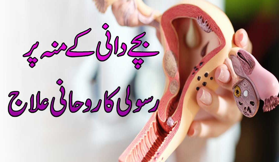 Bachedani Ke Muh Par Rasoli Ka Ilaj