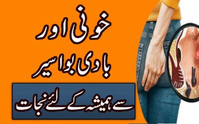 Khooni  Bawaseer Se Shifa Ka Taweez
