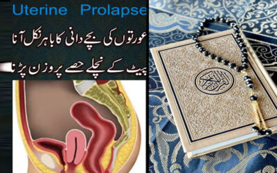 Bache Dani Bahar Ajane Ka Ilaj