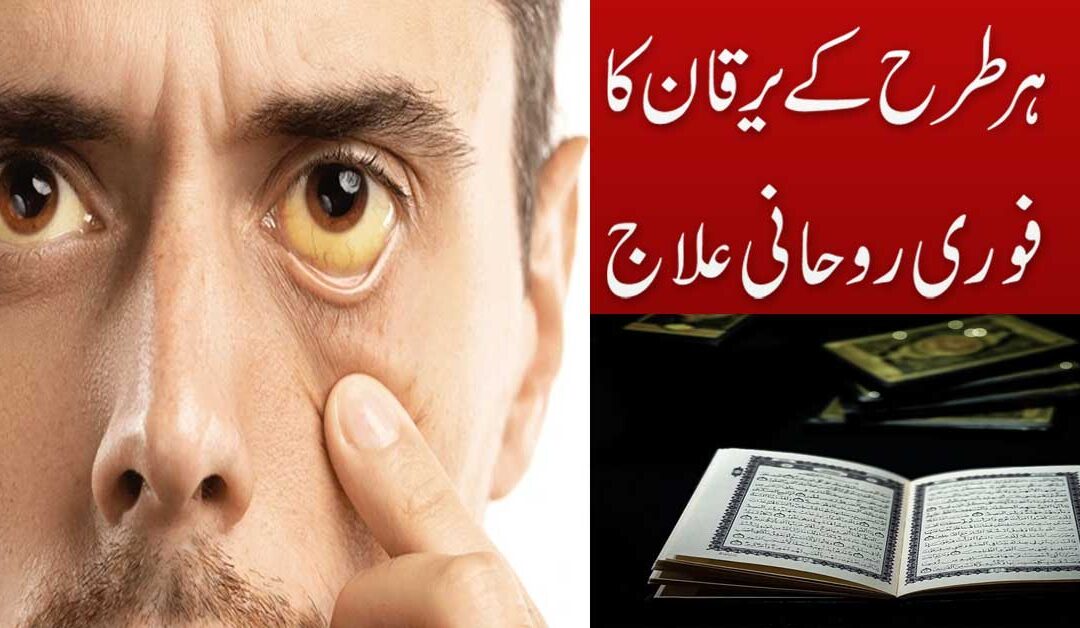 Har Tarha K Yarkan Ka Fori Ilaj