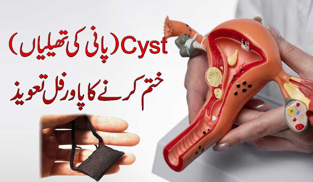 Cyst Pani Ki Theliyan Khatam Karne Ka Taweez