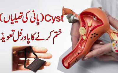 Cyst Se Shifa Ka Powerful Taweez